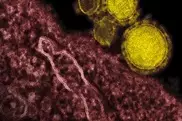 Widest study highlights risks from MERS virus 
