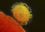 Deadly Middle East respiratory virus strikes in US