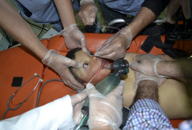 A boy affected by what activists say was a gas attack. ©Reuters/Amer Alfaj 