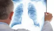 New lung transplant technique could save lives