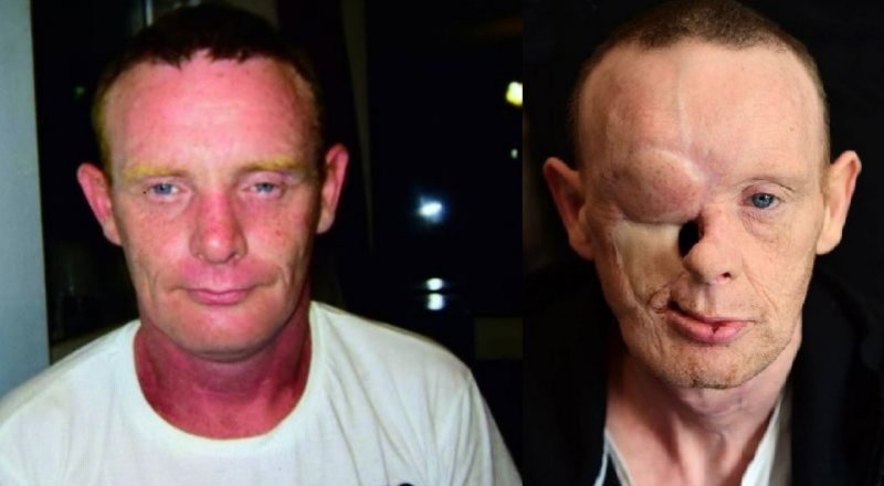 Өмірімде бірінші рет онлайн фистинг туралы бейне