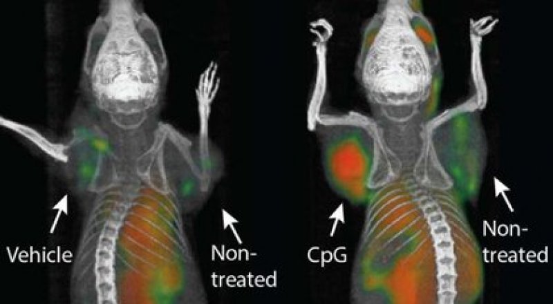 © Sagiv-Barfi et al / Science Translational Medicine