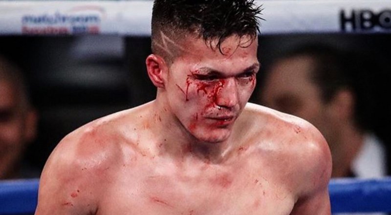 Димаш Ниязов соңғы жекпе-жегінен. © instagram/lightning_dimi