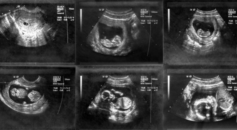 © Настоящее Время