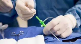 Алматылық дәрігерлер ерекше операция жасады