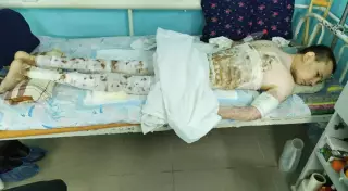 Зейнеткерді өрттен құтқарған ақтөбелік сегіз айдан бері қиналып жатыр