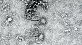 Ғалымдар коронавирусқа қарсы вакцина ойлап тапты