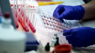 Қатерлі ісікке жиі шалдығатын қан тобы аталды