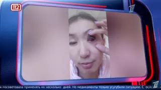 Кентау тұрғыны сұлулық салонынан кейін ауруханаға түсті