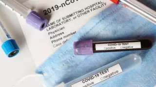 9 адамнан коронавирус анықталды