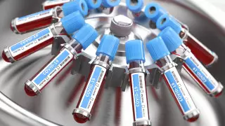 Қазақстанда тағы 15 адамнан коронавирус анықталды