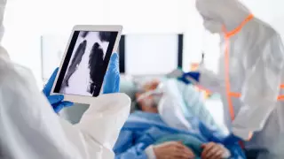 COVID-19 белгілері байқалмаған науқастардың өкпесі қалай зақымданатыны айтылды