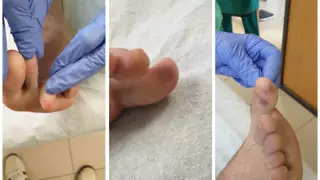 Дәрігерлер коронавирустың тағы бір белгісін атады