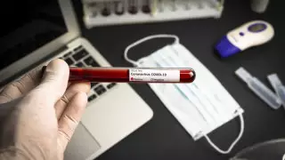 Қазақстанда COVID-19-дан сауыққандар саны 442-ге жетті