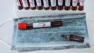 Дүниежүзінде коронавирус жұқтырғандар саны 2,5 миллионнан асты