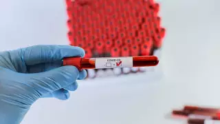 АҚШ-та коронавирустың бұдан да ауыр кезеңі болады деп болжанды