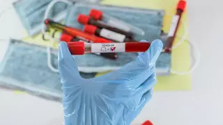 Қазақстанда коронавирустың екінші толқыны қашан болатыны айтылды