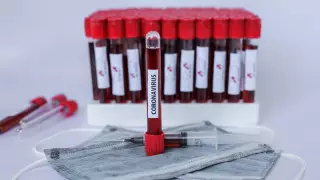 Қазақстанда тағы 16 адам COVID-19 жұқтырды