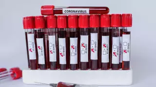 Алматы бір тәулікте COVID-19 жұқтырғандар саны бойынша антирекорд орнатты