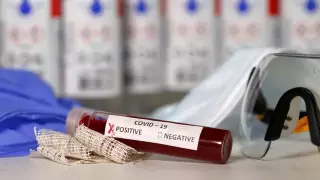 Қазақстанда тағы 72 адам COVID-19 жұқтырды