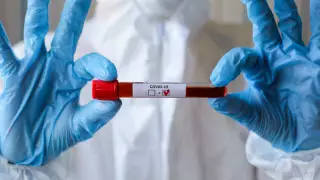 Қазақстан бойынша коронавирустан сауыққандар саны 1695 болды