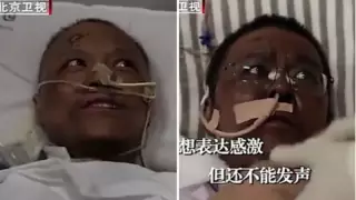 Коронавирустан қарайып кеткен қытайлық дәрігер ағара бастады