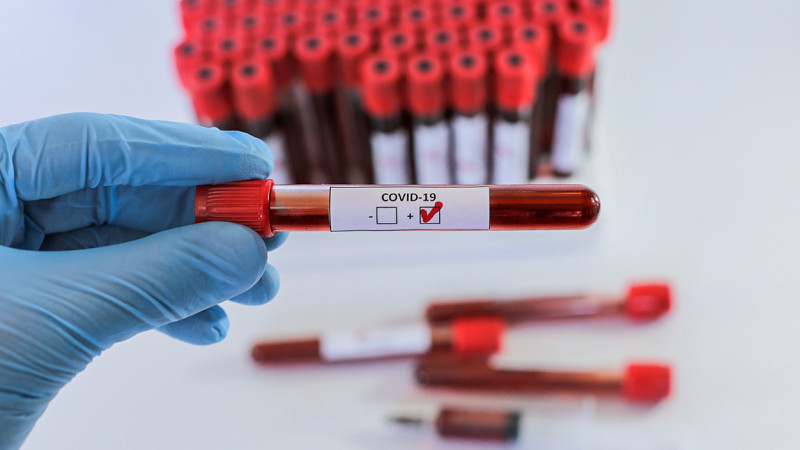 Фото: Әлихан Сариев