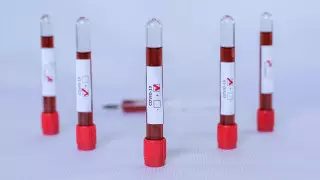 Қазақстанда коронавирус жұқтырғандардың саны 8 мыңнан асты