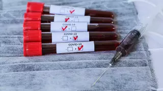 Қазақстанда коронавирустан тағы екі адам қайтыс болды