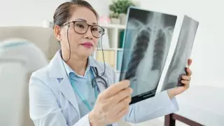 Сағынтаев қалада туберкулез тарап жатыр деген мәліметке қатысты пікір білдірді