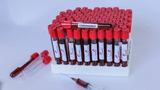 Коронавирус: дүние жүзі бойынша 28 мамыр таңғы жағдай