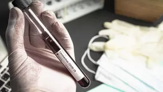 Әлем бойынша коронавирустың алты түрі тарап жатыр - ғалымдар