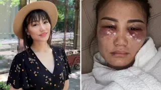 "Жігіті ұрып-соғып, ақшасын тартып алған". Алматылық қыз сұмдық суреттер жариялады