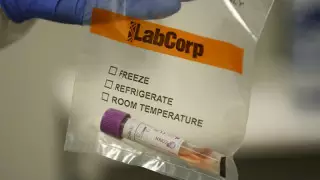 Қазақстанда тәулік ішінде симптомы жоқ 656 адам анықталды