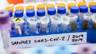 Қазақстанда тағы 534 адамнан COVID-19 анықталды