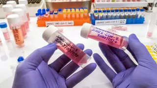 Алматыда лабораториялардың неліктен жабылғаны белгілі болды