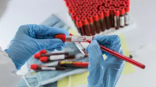 Қазақстанда бір күнде симптомсыз мыңнан аса адам тіркелді