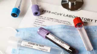 Коронавирус: әлемде 17 вакцина сынақтан өткізіліп жатыр