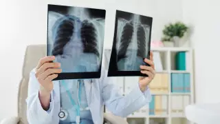 Дәрігер пневмонияның алғашқы симптомдарын атады