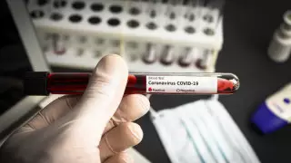 Иммунолог COVID-19 жұқтыру қаупі төмен адамдарды атады