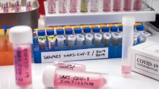 Денсаулық сақтау министрлігі бюджеттен тағы 42 миллиард теңге сұрады