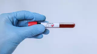 Коронавирус: елдегі науқастар саны 87 мыңнан асты