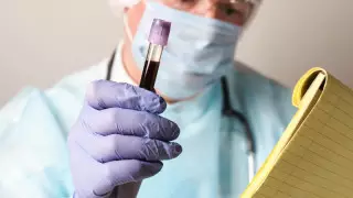 Қазақстанда өткен тәулікте 691 адам коронавирус жұқтырды