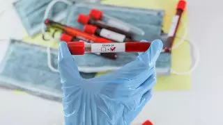 Елімізде тағы 271 адамнан коронавирус анықталды