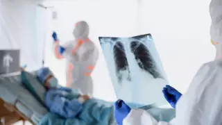 Қазақстанда тағы 531 адамнан коронавирус пневмониясы анықталды