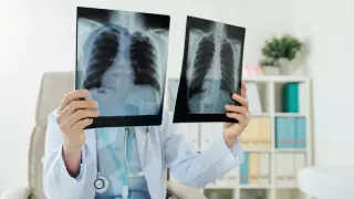 Өткен тәулікте 8 адамнан пневмония анықталды