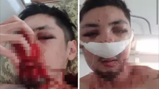 Елордада күзетшілер 19 жастағы жігітті аяусыз ұрып-соқты деген күдікке ілінді