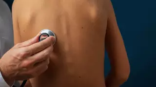 Дәрігерлер өкпе қатерлі ісігінің адам күтпеген белгісін атады