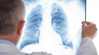 Кейінгі тәулікте қанша адамнан пневмония анықталды?