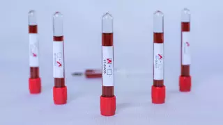 Пневмония анықталған қазақстандықтар бойынша жаңа дерек жарияланды